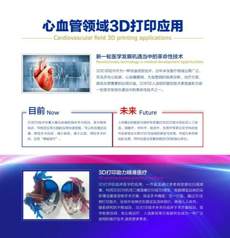 心脏模型3D打印