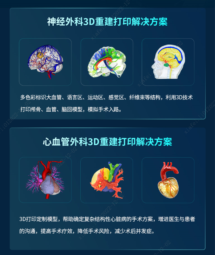 心血管神经外科3D打印