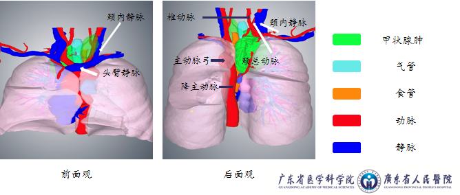 赛纳数字医疗医学三维重建