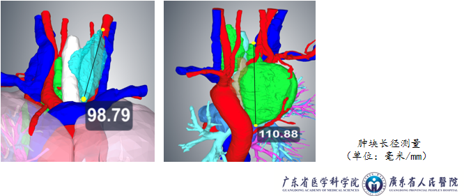 赛纳数字医疗医学建模