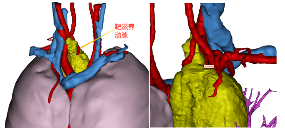 赛纳数字医疗三维重建